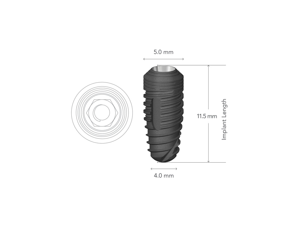 StarVent MT 5.0 x 11.5 mm Internal Hex Implant w/ Cover Screw