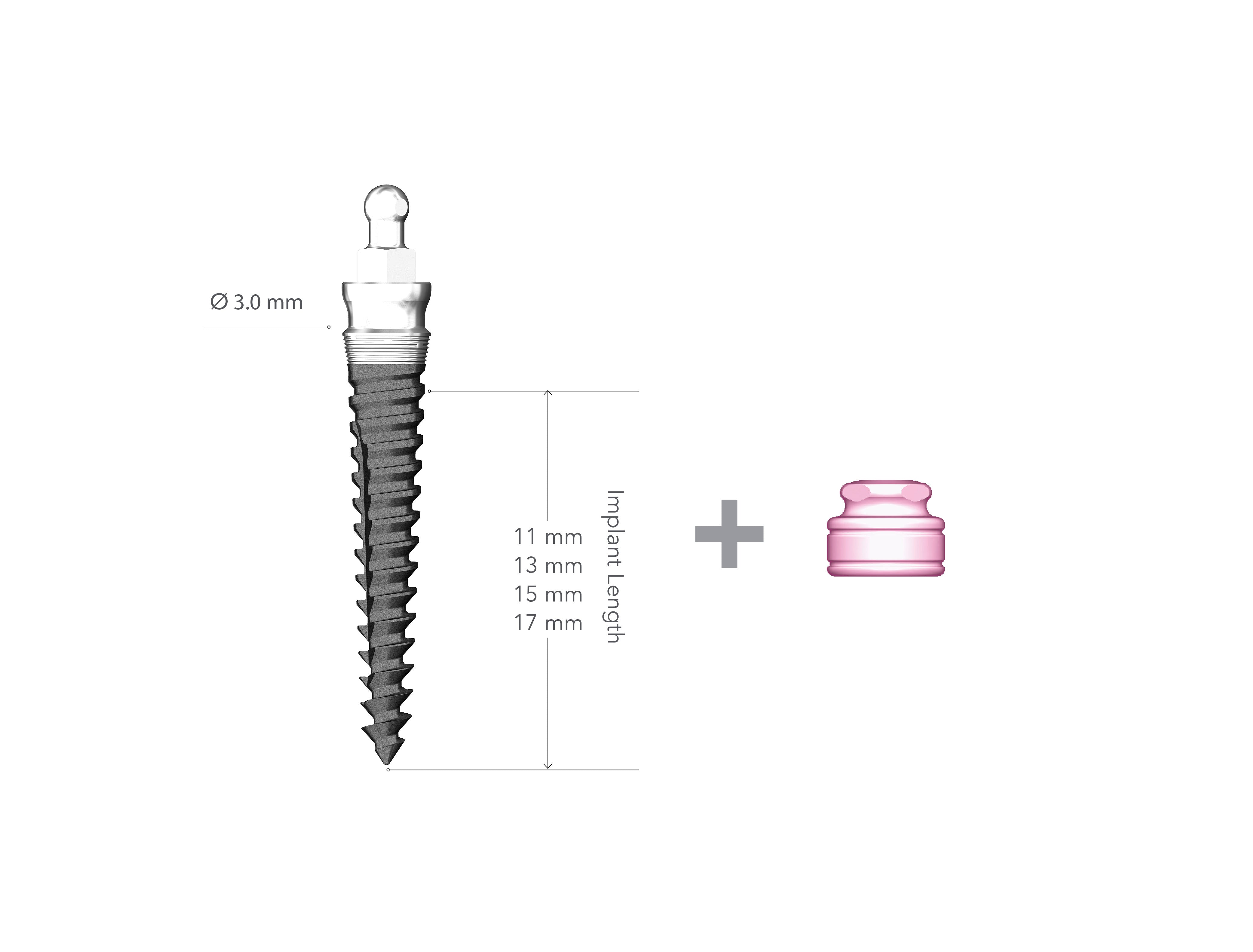 Lew 3.0 x 17mm Collared Implant with MH2