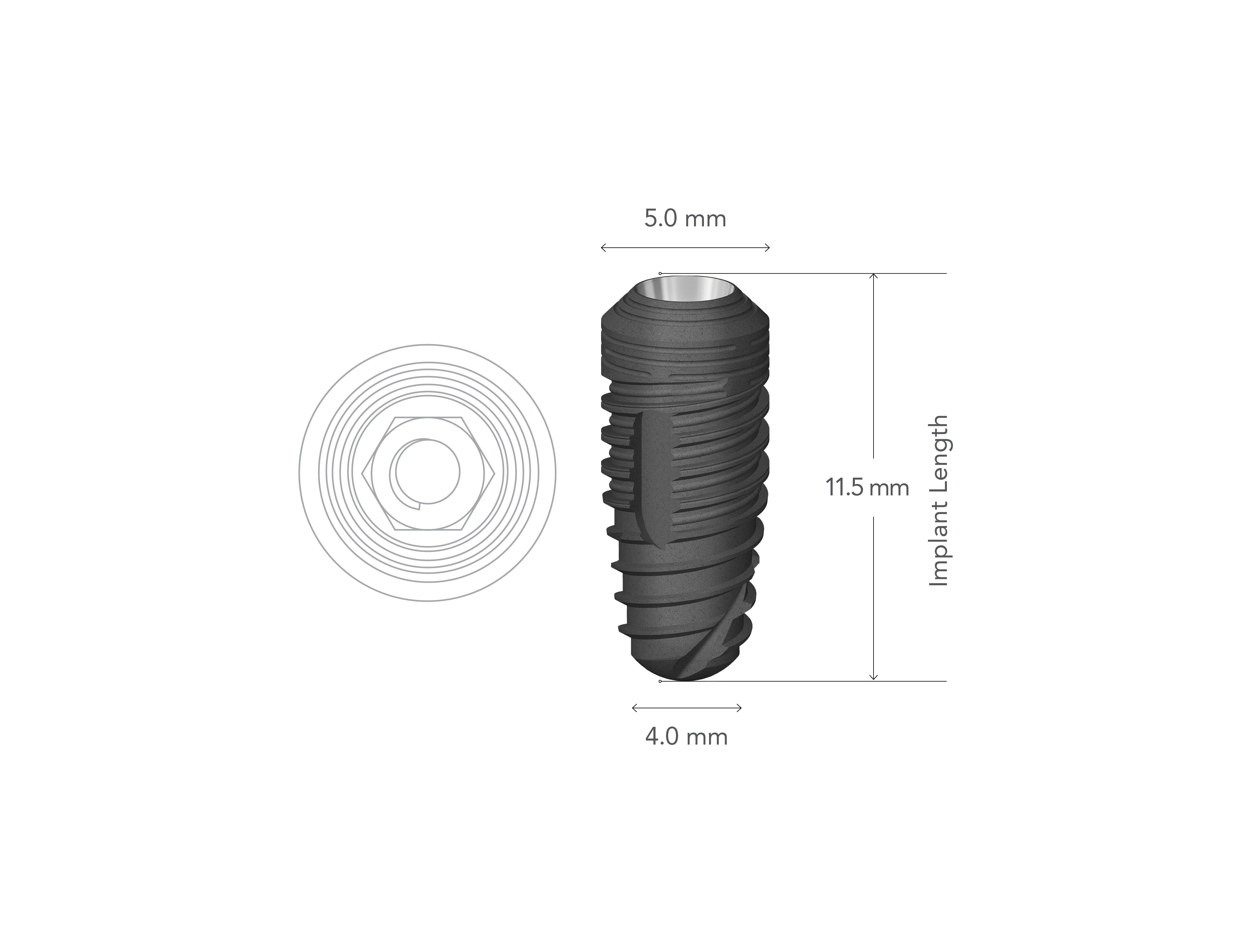 StarVent MT 5.0 x 11.5 mm Internal Hex Implant w/ Cover Screw