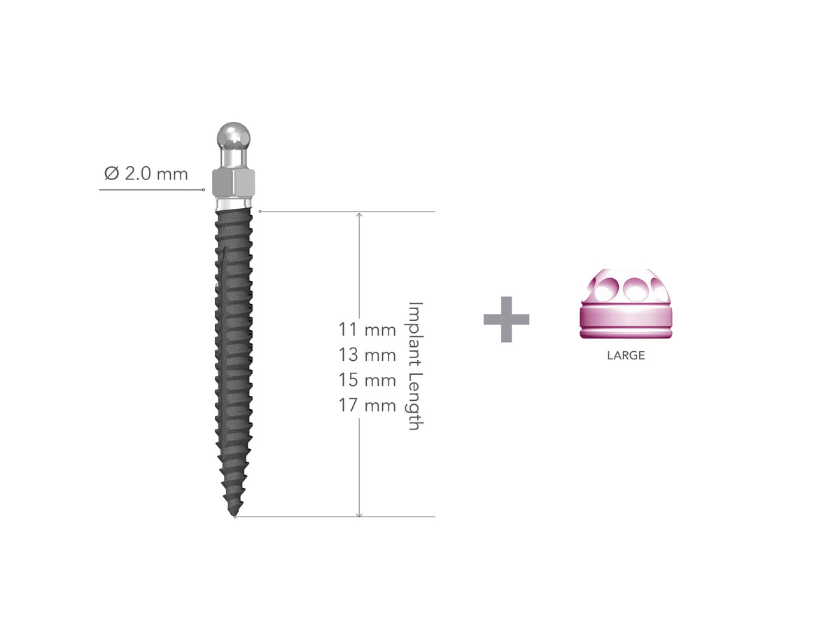 Lew 2.0 x 13mm Non-Collared Implant with MH1