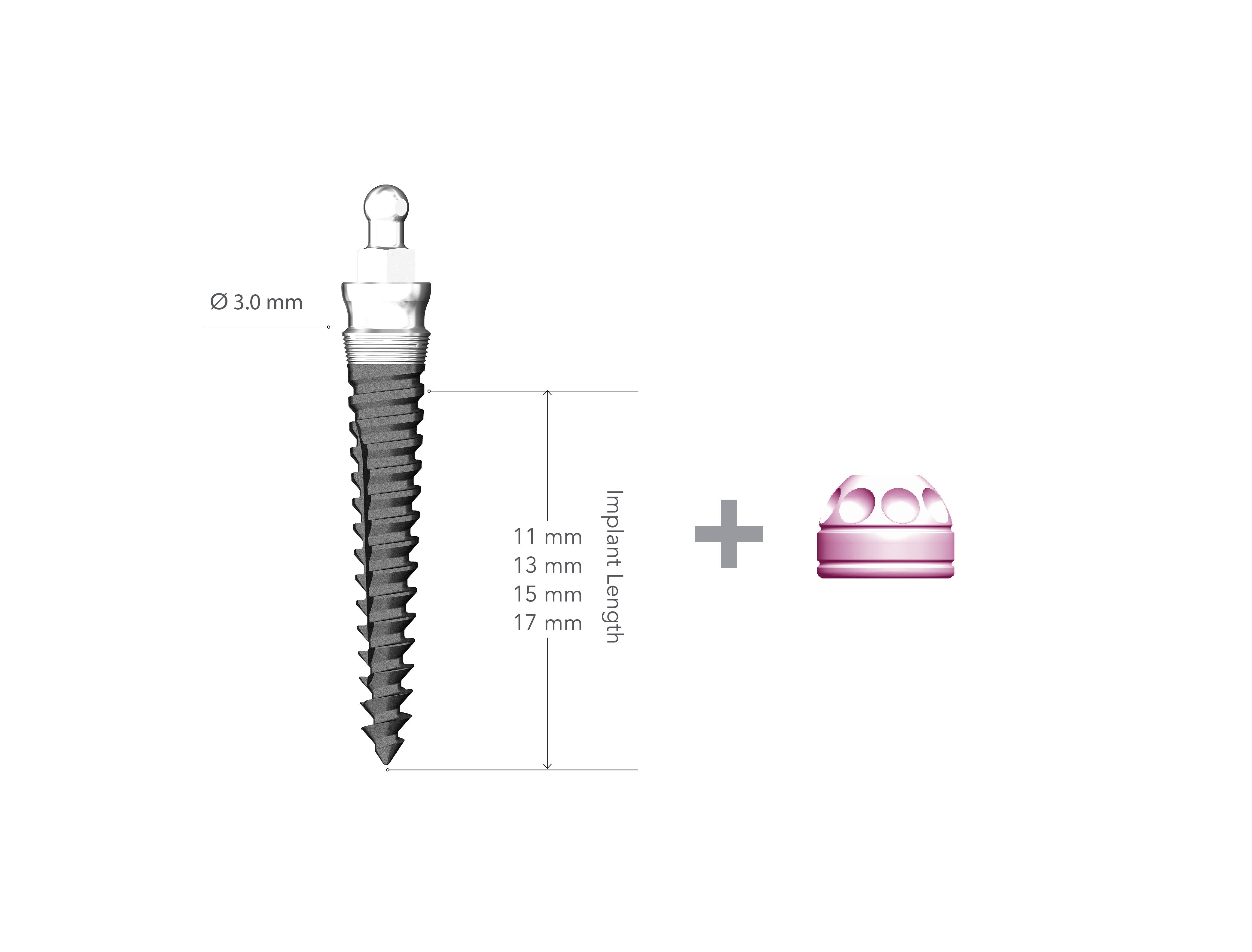 Lew 3.0 x 15mm Collared Implant with MH1