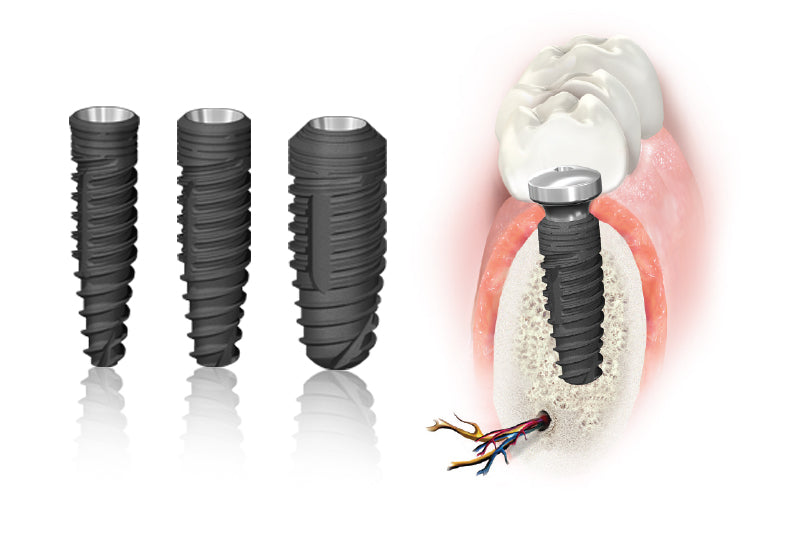 StarVent™ Implant system